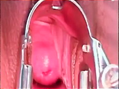 Tera Joy, close-up, doctor, fetish, gape, gyno, kinky, pornstar, pussy, reality, speculum