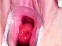 doctor, fetish, gyno, kinky, pussy, speculum, vagina, teenager, exclusiveclub.com, closeups