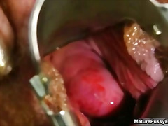 bizarre, doctor, fetish, hairy, housewife, kinky, mature, old