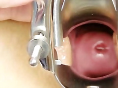 blonde, medical, speculum, pussy-eating, closeup, hospital, clinic, enema, pumped