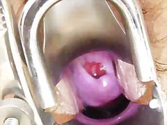 bizarre, doctor, mature, milf, mom, pussy, wife, check, cervix
